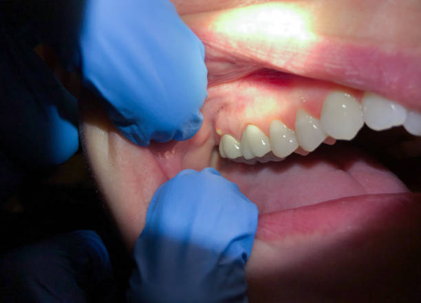 Best After-Hours Dental Care in Fort Gibson, OK